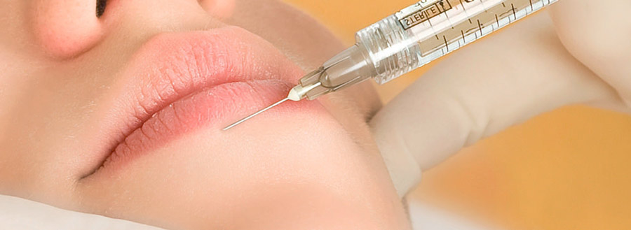 Как делают гиалуроновые уколы в губы?