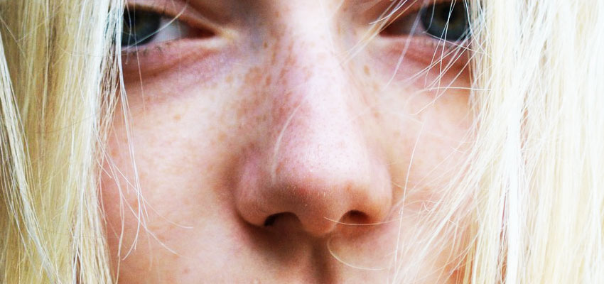 Что из себя представляет безоперационная ринопластика носа - фото до и после